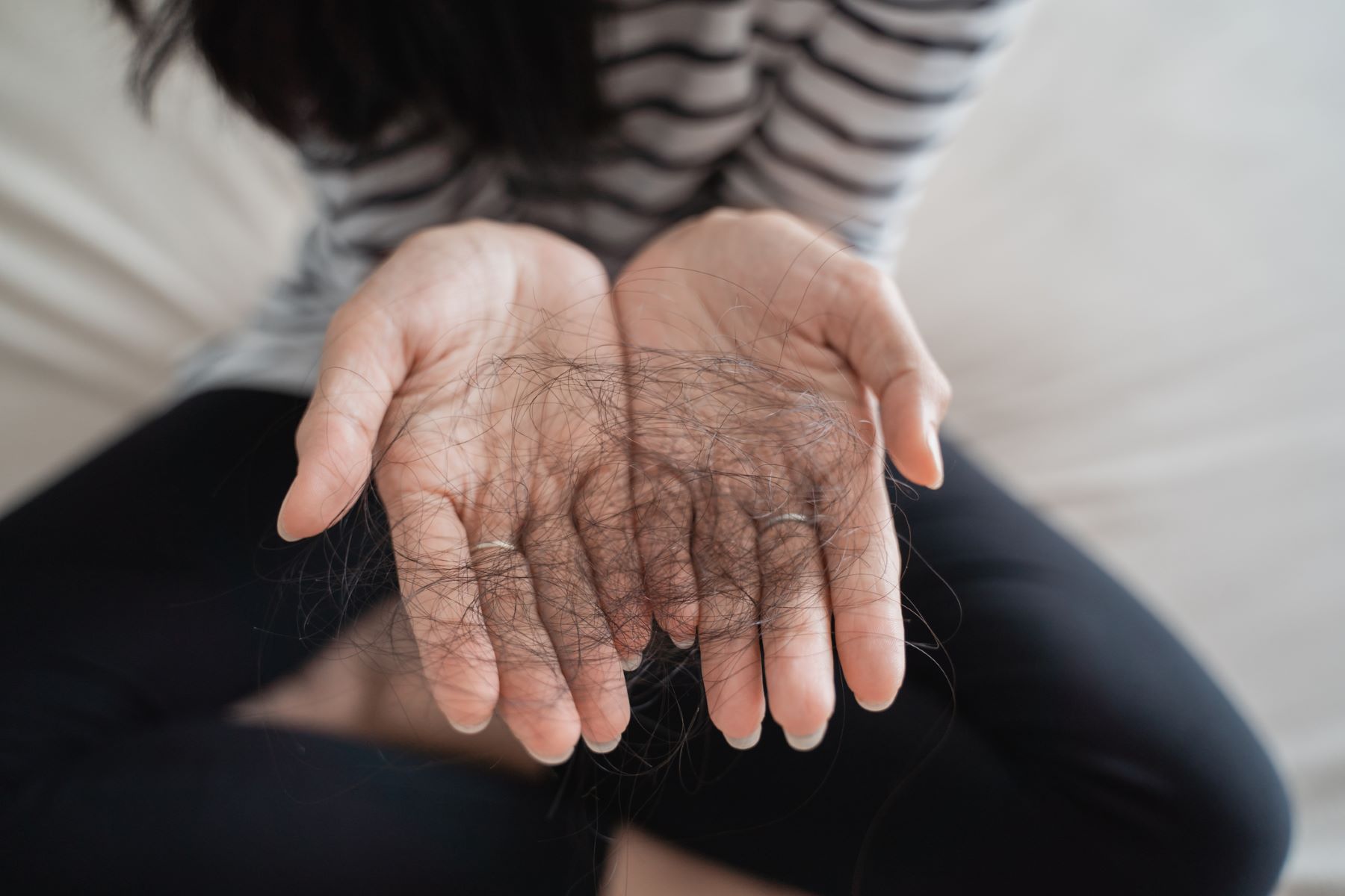 Woman showing shed hair