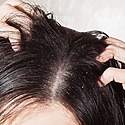 10 Science-Backed Ways To Treat Your Dry Scalp At Home