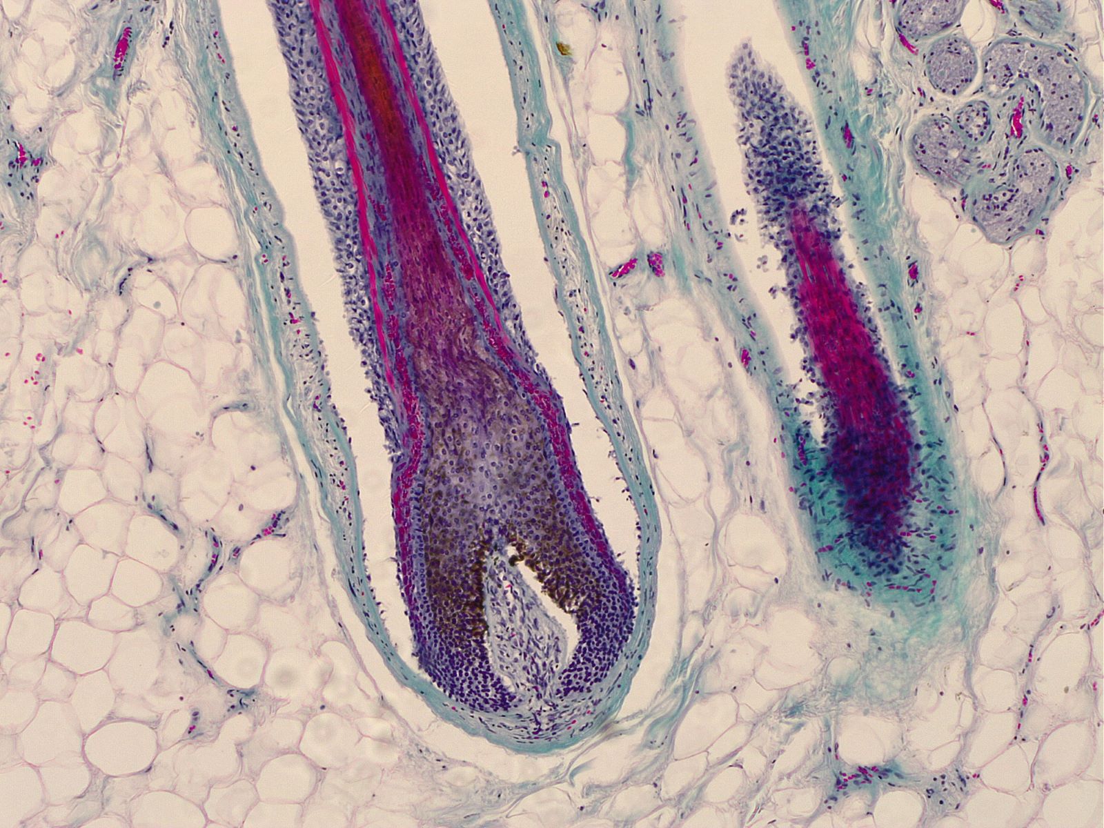 A hair follicle under the microscope