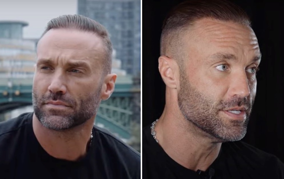 Calum Best’s hair in 2024