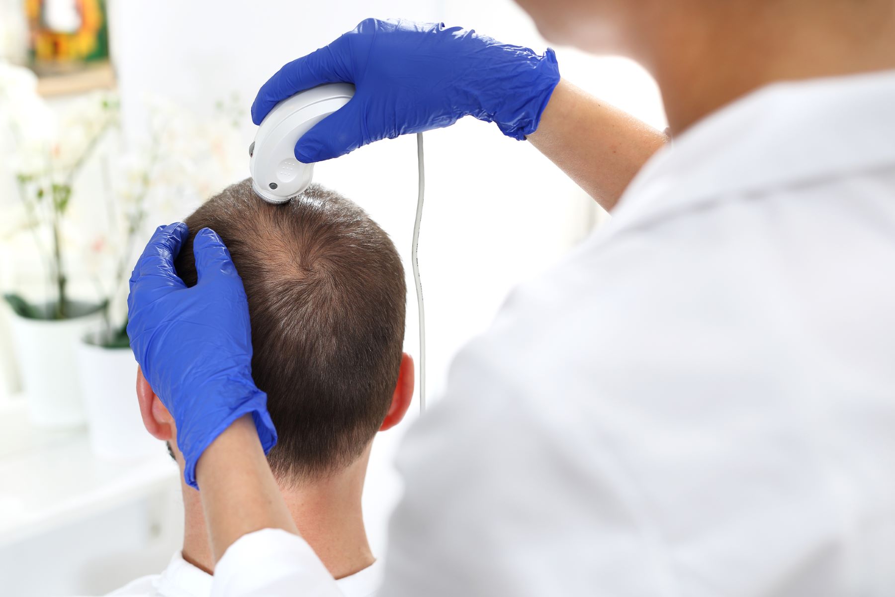 Doctor examining the patient for hair follicle infection