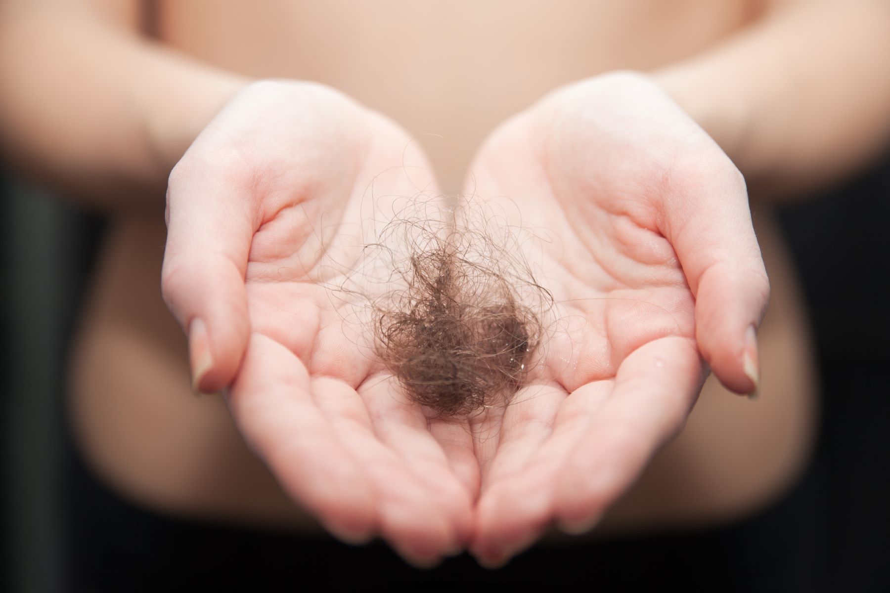 Hair loss resulted from untreated hair follicle infection