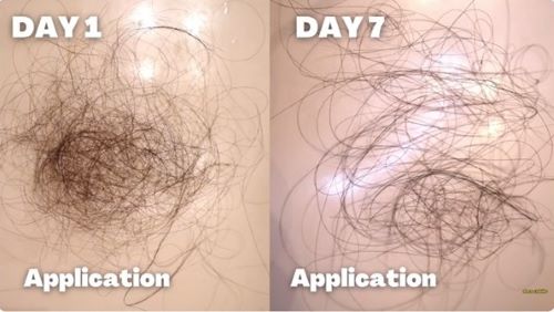 Hair on day 1 vs day 7 of onion juice application