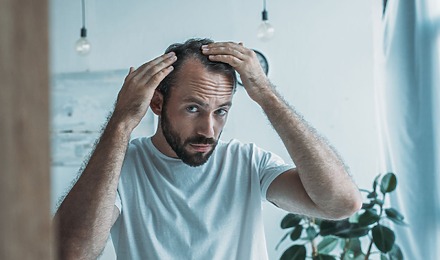 How To Reverse Balding