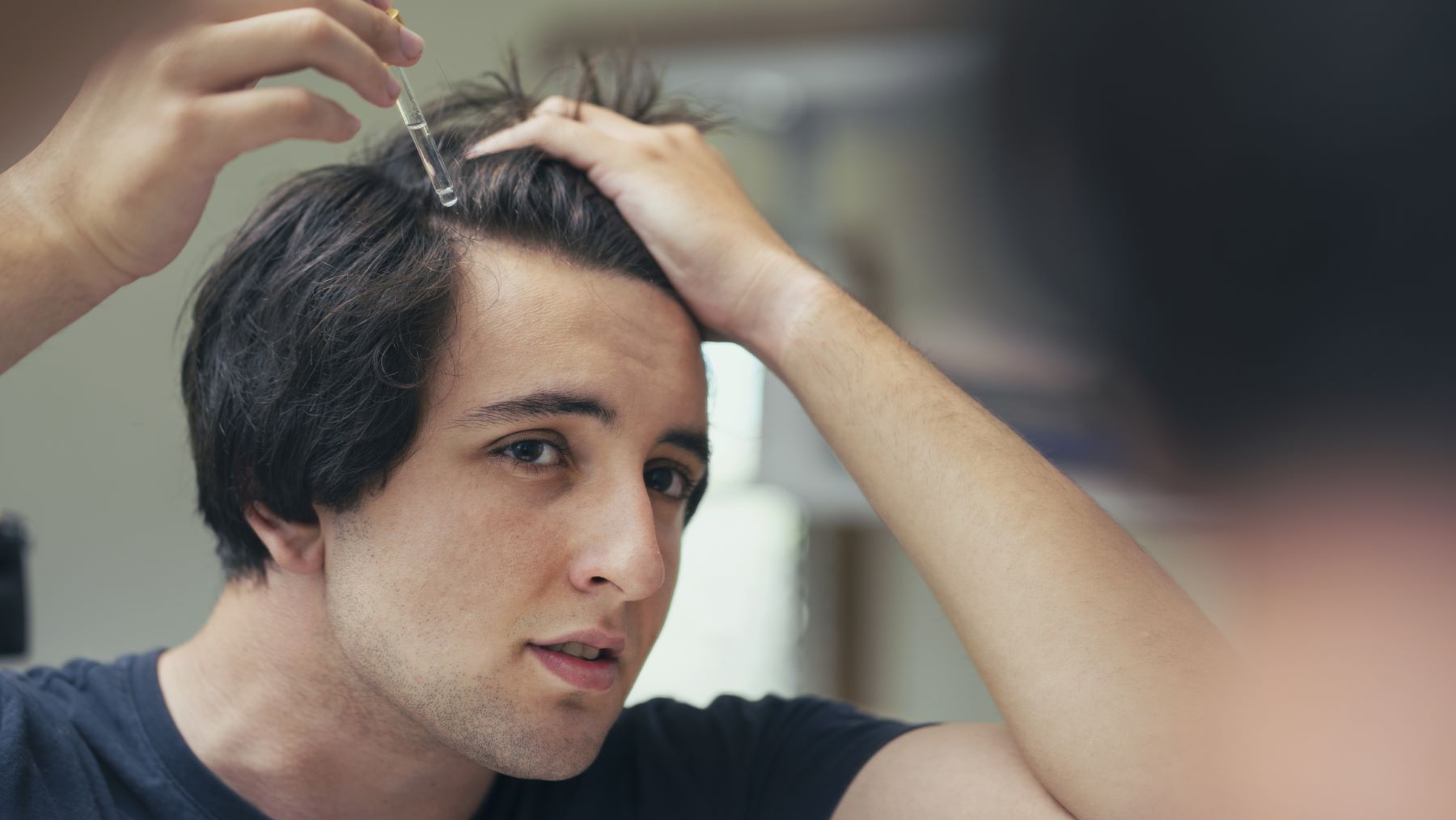 Man applying Minoxidil to hairline