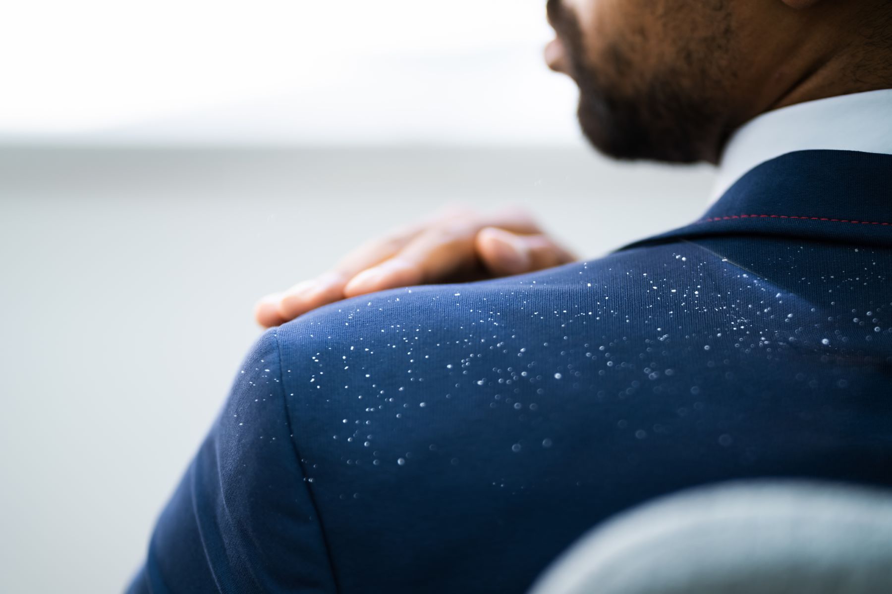 Man with dandruff