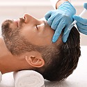 PRP Hair Treatment London: How To Find The Best PRP Clinic