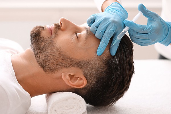 PRP Hair Treatment London