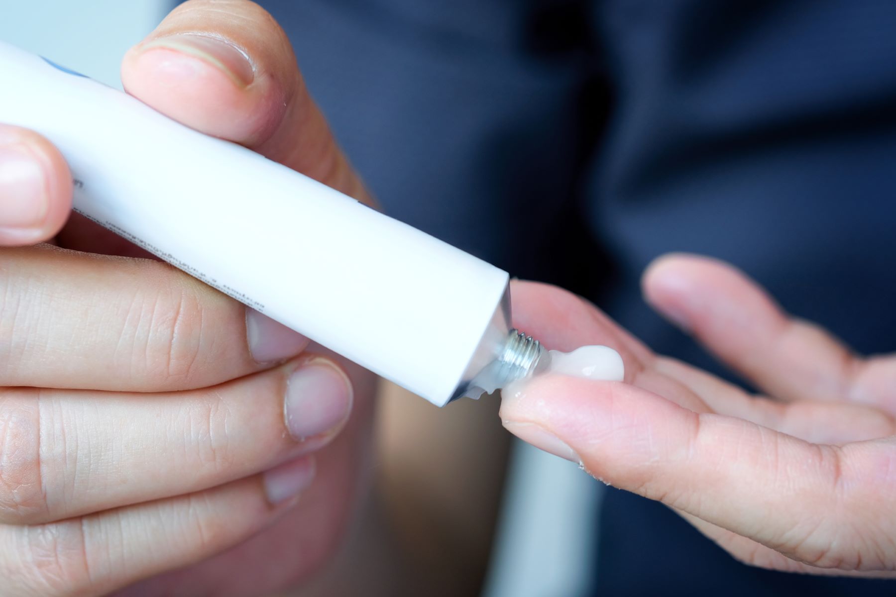 Patient using a corticosteroid cream