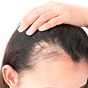 Which Hormones Cause Hair Loss In Women?