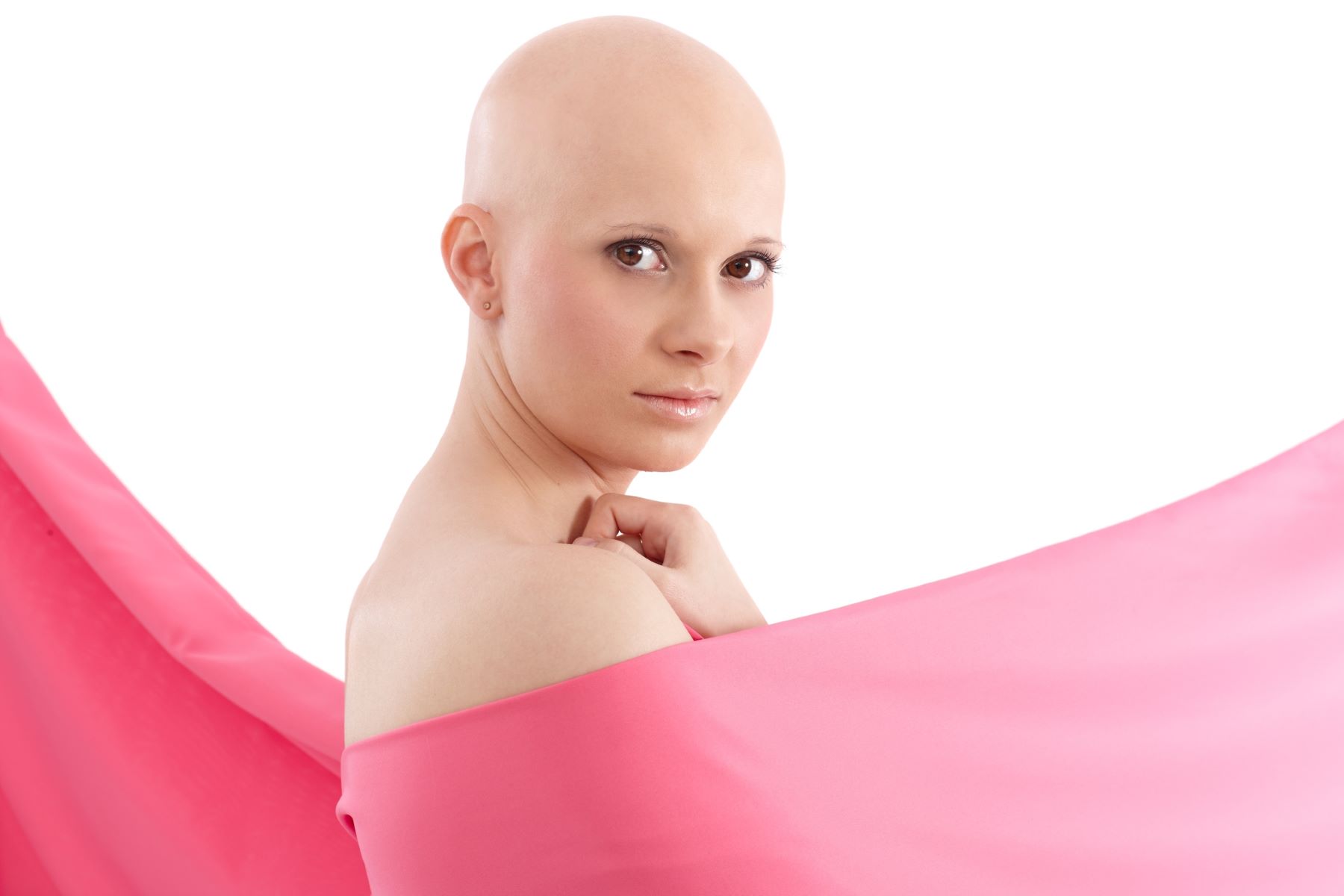 woman with chemotherapy-induced hair loss