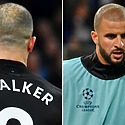Did Kyle Walker Get A Hair Transplant?