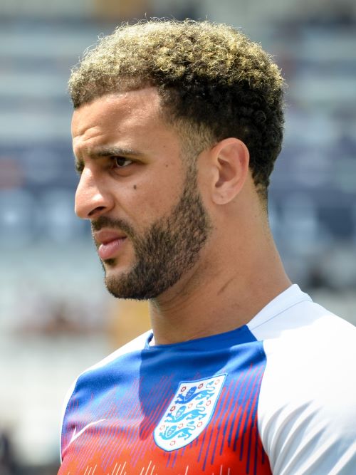 Kyle Walker in 2019 with a slightly uneven hairline