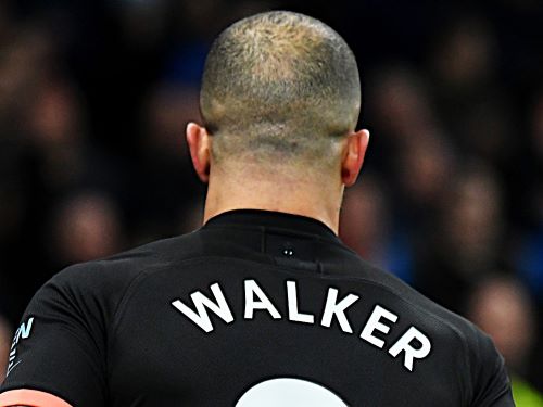 Kyle Walker in February 2020 with a balding crown