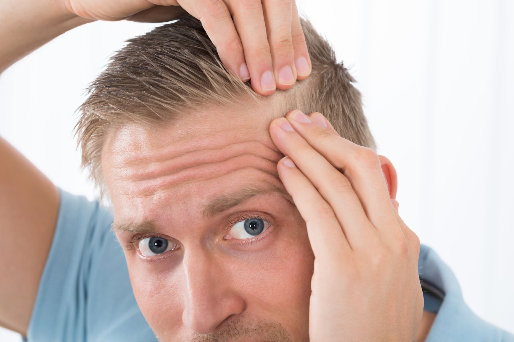 Man examining hair loss