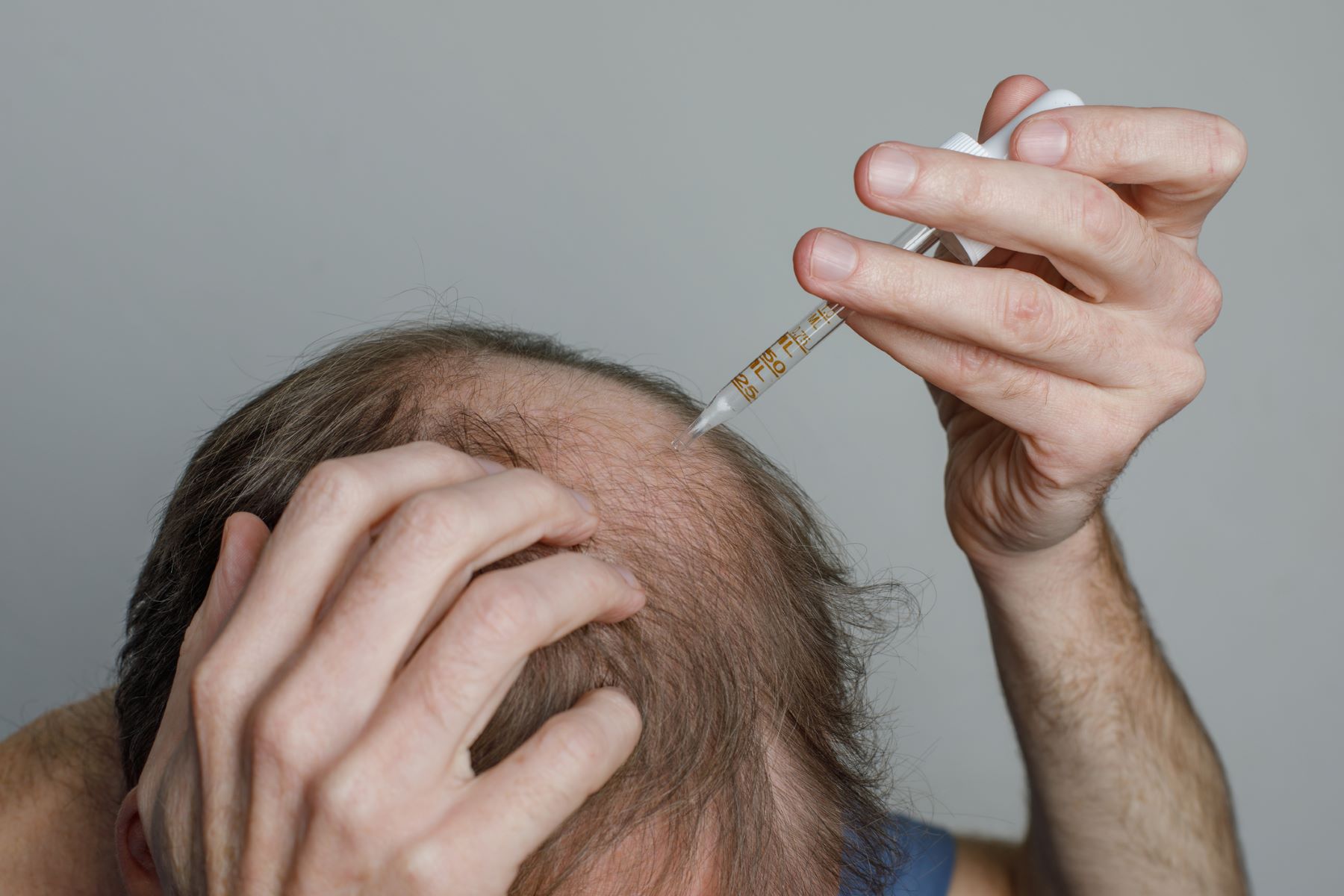 Man using Minoxidil