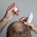 Manual Hair Loss Review: Can It Reverse Male Pattern Baldness?