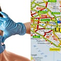 PRP Hair Treatment Liverpool: How To Find The Perfect Clinic