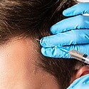 PRP Hair Treatment Manchester: Choosing The Right Clinic