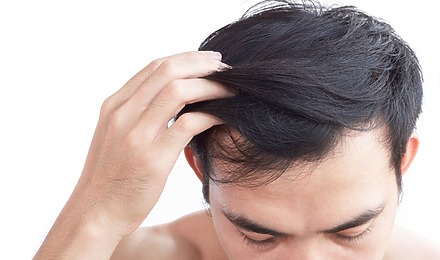 Sons Hair Loss Review: Do Sons Products Really Work?