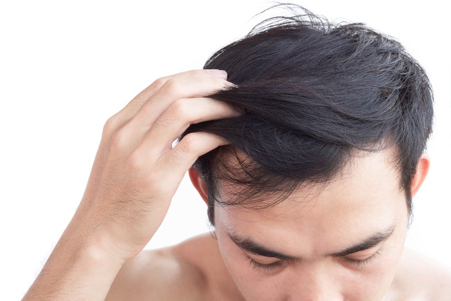 Sons Hair Loss Review: Do Sons Products Really Work?