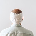 When Can I Remove My Hair Transplant Bandage?