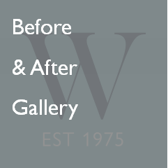 Before and after gallery