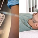 Does Stem Cell Hair Treatment Work? And What Are The Risks?