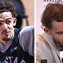 Is Trae Young Balding? How His Hair Has Changed