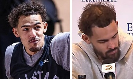 Is Trae Young Balding? How His Hair Has Changed