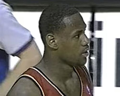 LeBron James hairline 2003