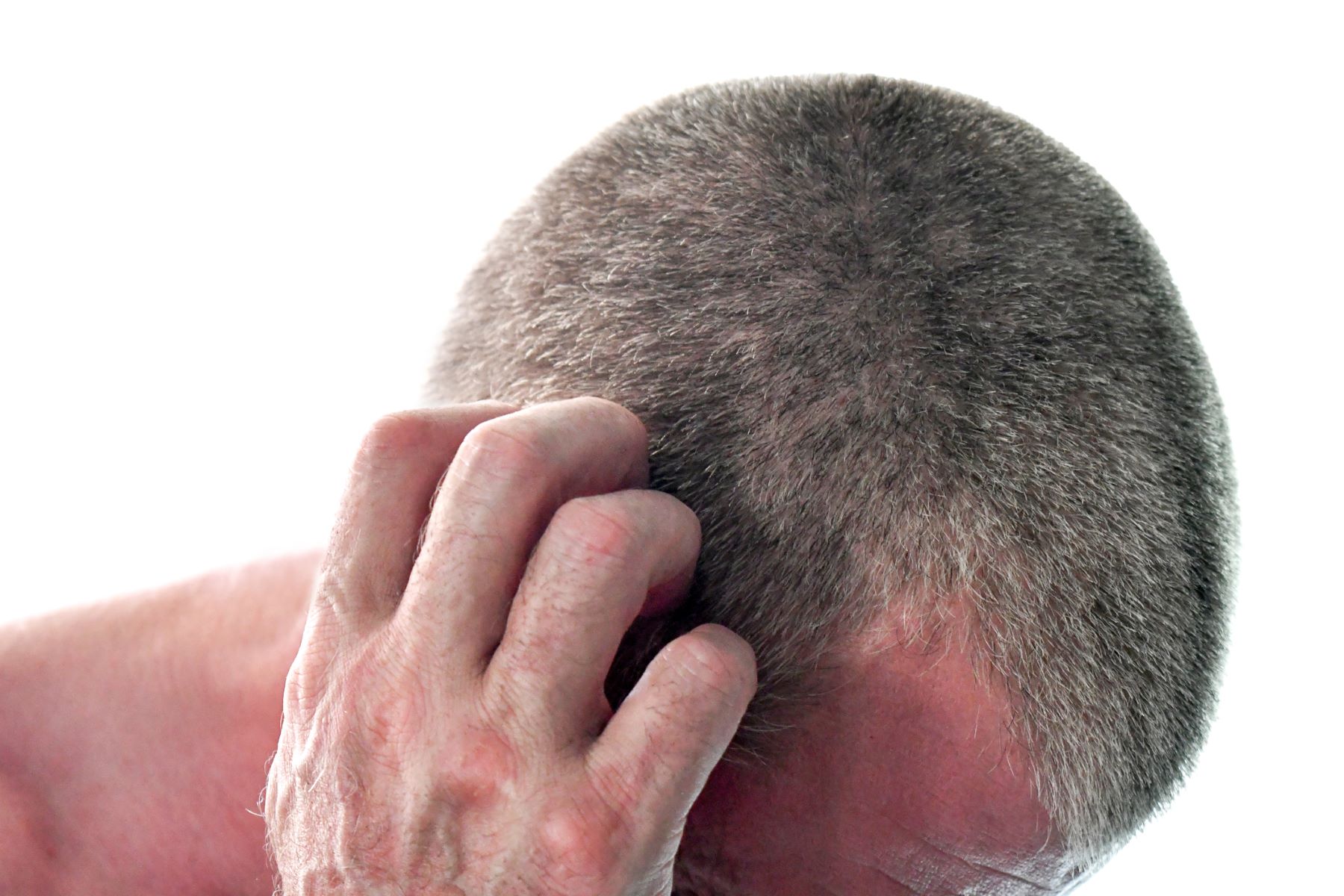 Man experiencing scalp itching