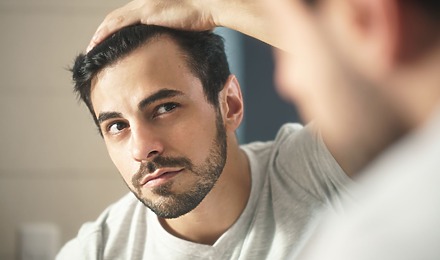 Man With High Hairline