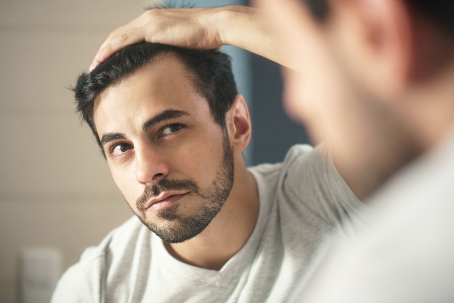 Man With High Hairline