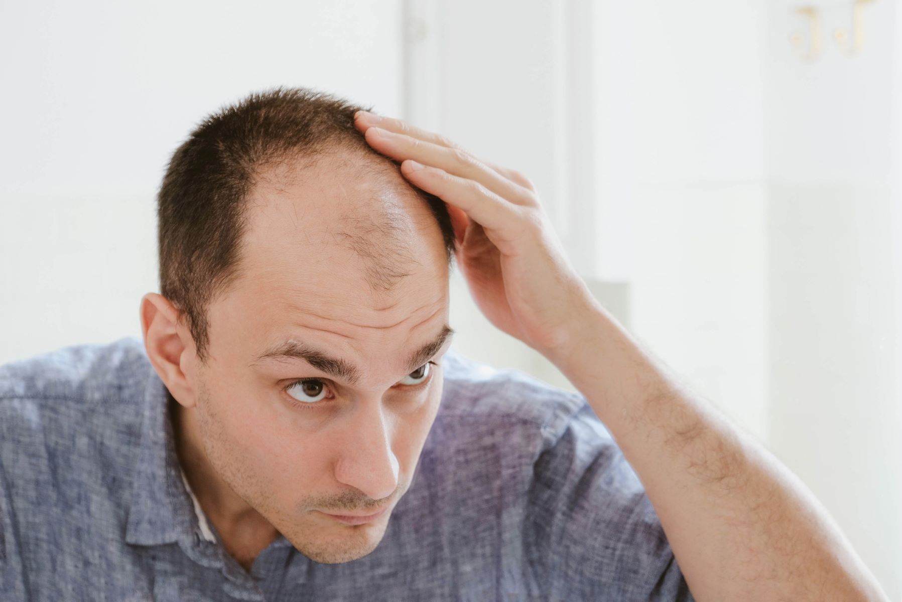 Man with male pattern baldness