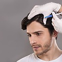 PRP Hair Treatment Birmingham: Proven Regrowth In 3 Months