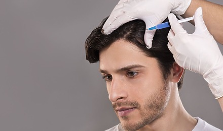 PRP Hair Treatment Birmingham