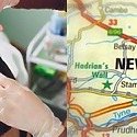 PRP Hair Treatment Newcastle: All You Need To Know