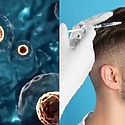 What Does Stem Cell Hair Treatment Cost And Is It Worth It?
