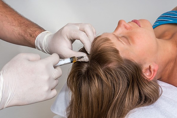 Woman getting PRP hair treatment