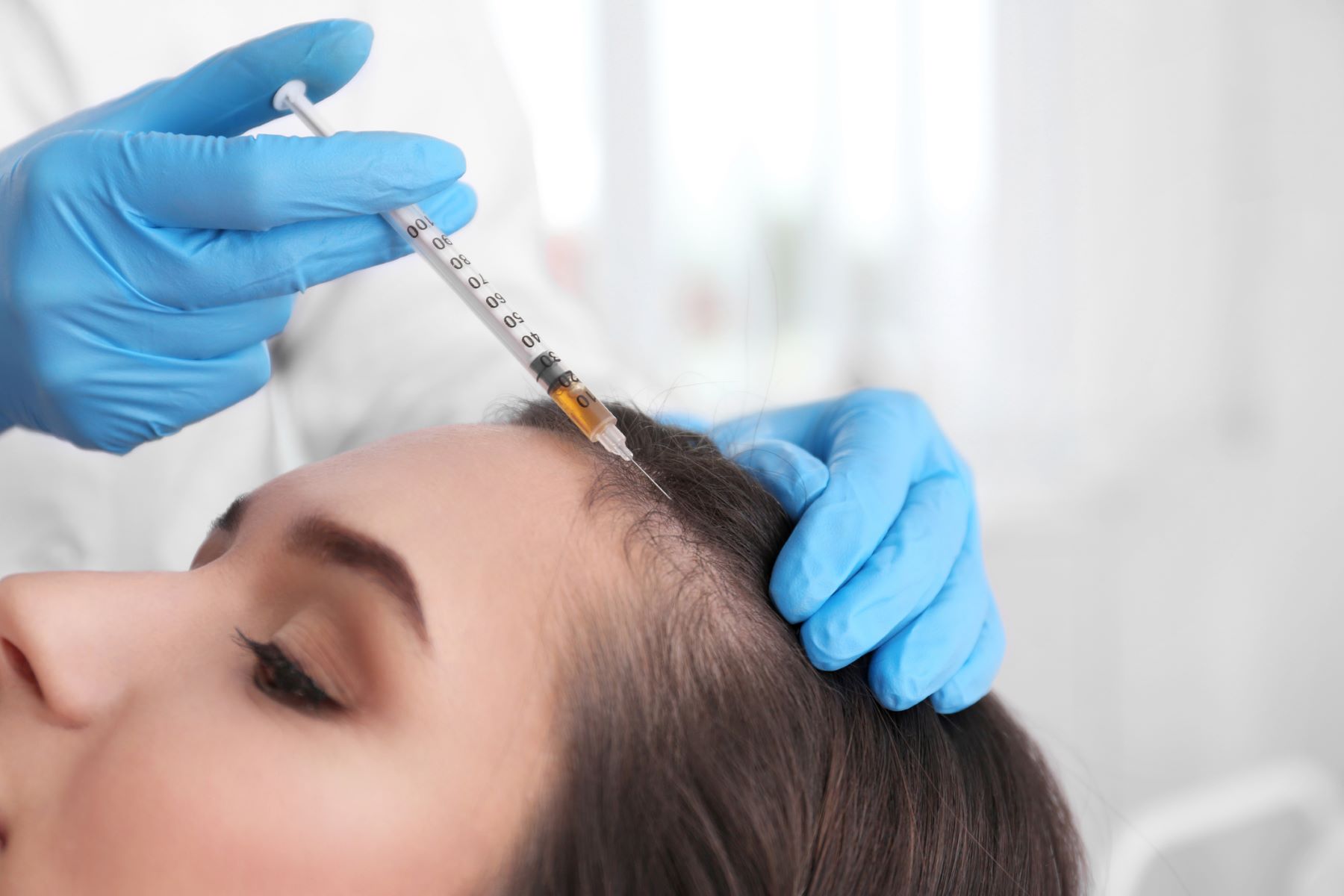 Woman getting stem cell hair treatment