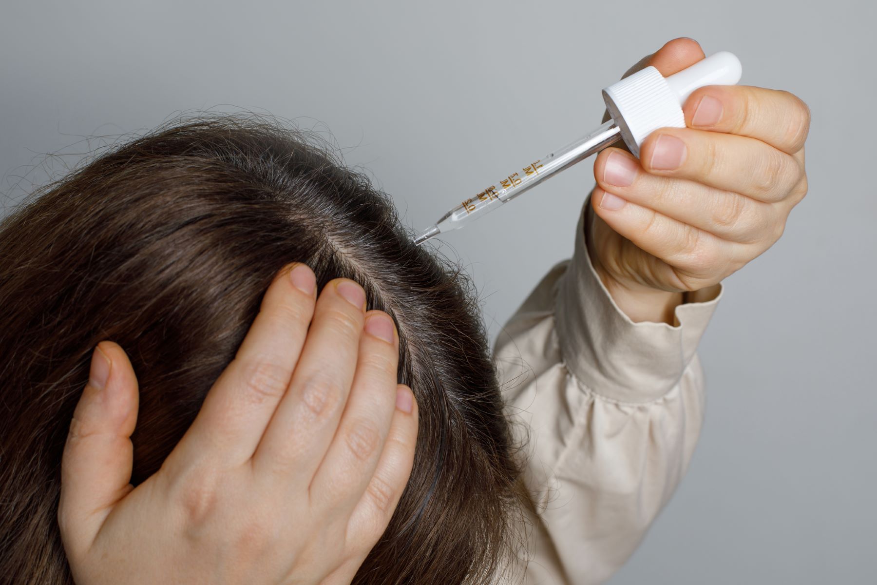 Woman treating diffuse unpatterned alopecia