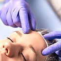 Hairline Correction Surgery: What It Is And How It Works