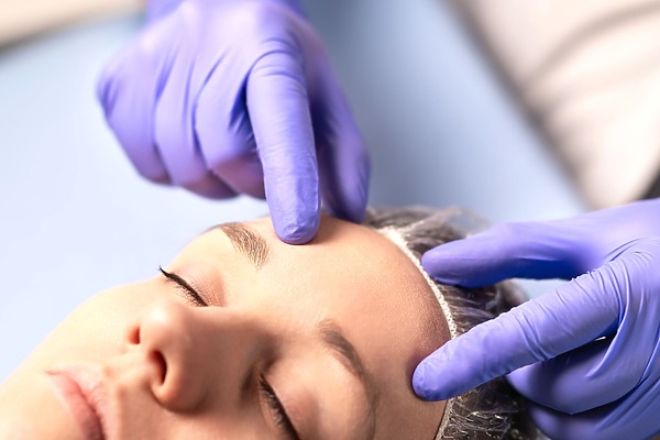hairline correction surgery