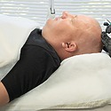 PRP Hair Treatment Glasgow Vs. Other Hair Restoration Options