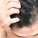 When Can I Rub My Head After A Hair Transplant? A Full Guide