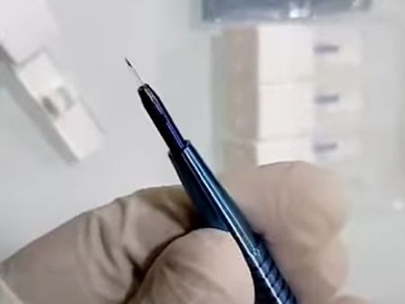 A scalpel with a sapphire blade used in hair transplants