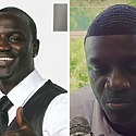 Akon Hair Transplant: Everything You Need To Know