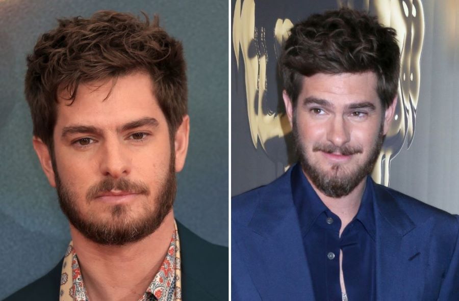 Andrew Garfield’s 2024 hairline