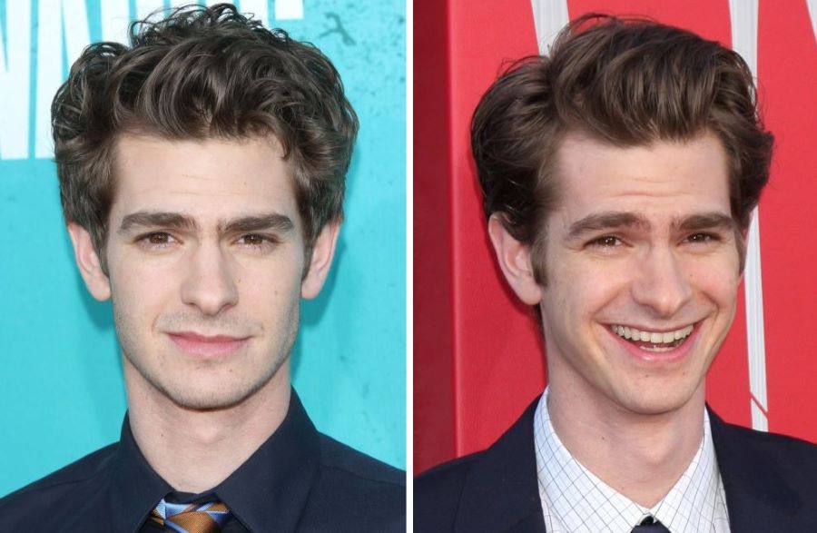 Andrew Garfield’s hairline 2012